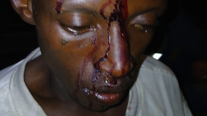 Ibiyobyabwenge bikomeje guteza urugomo i Nyarugenge; abaturage batakambiye inzego z’umutekano gutabara aba bana hakiri kare
