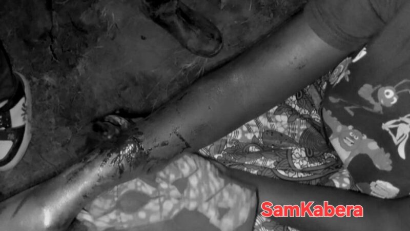 Nyamasheke: Umugabo Yatemye Umugore We Ku Kaboko Nyuma yo Kumwima Amafaranga